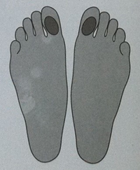 Описание: Лечение отеков ног массажем стопы